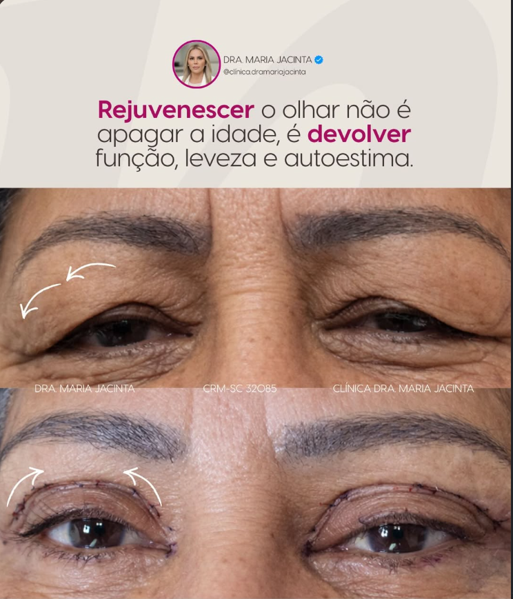 Um novo olhar — registro da clínica